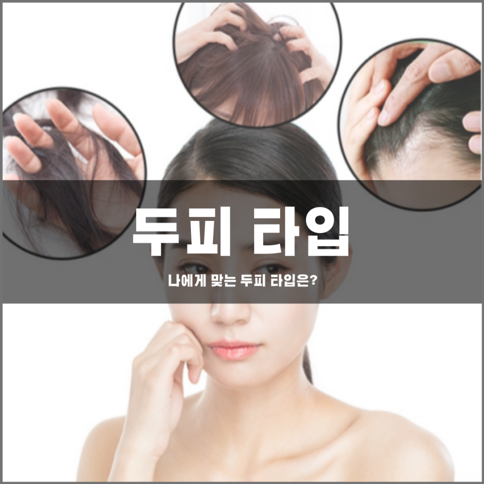 How do I know which scalp type is right for me? 